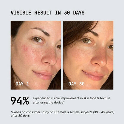 Refit Red Light Therapy Device